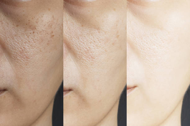 Gluta Pure-C Skin Brightening Facewash
